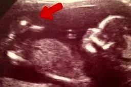 خبر شگفت انگیز/ این زن یک اردک را باردار است!+ عکس