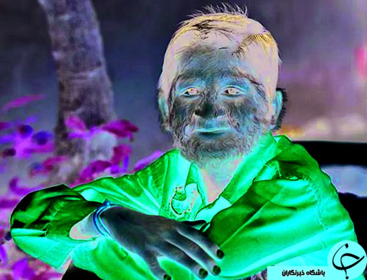 عجیب‌ترین پدیده‌های دنیای پزشکی؛ از مرد پاوربانکی تا به دنیا آوردن توده سنگی!