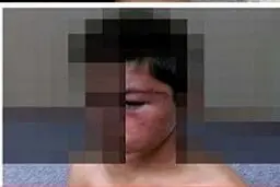 شکنجه وحشتناک پسر 12 ساله به دست پدر سنگدل در مشهد