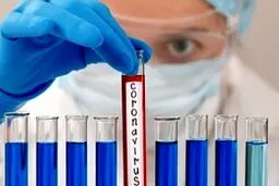 آمار مبتلایان در ایران ثابت مانده است