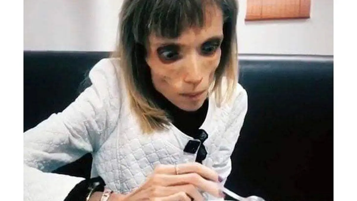 ترسناک ترین دختر 26 ساله را ببینید + عکس