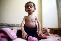 تصویری دردناک از تاثیر جنگ روی کودک سوری