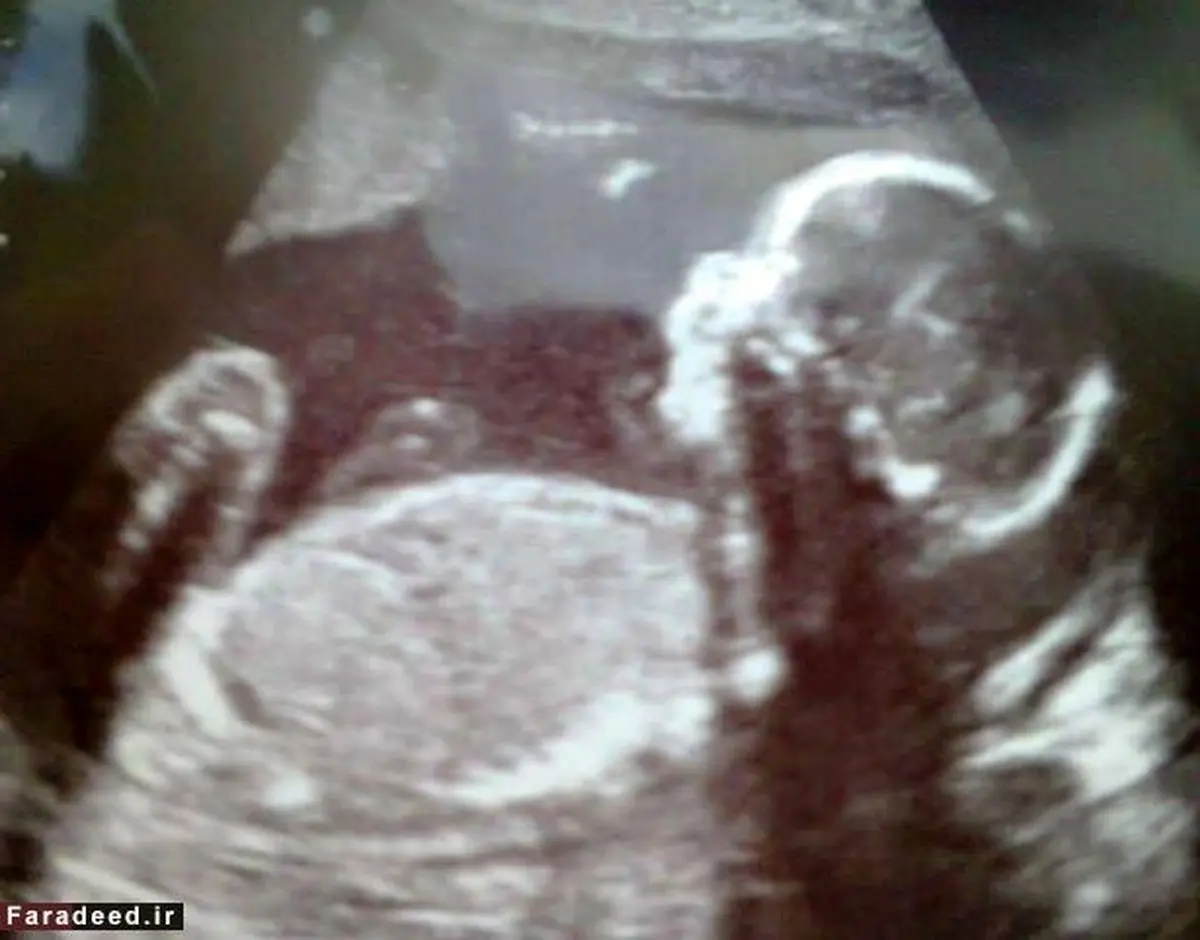 تصاویر/ پینوکیوی دنیای واقعی پیدا شد!