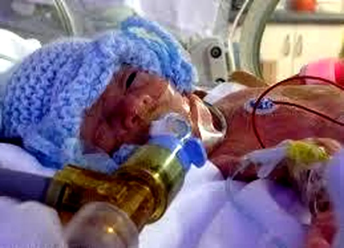 نجات کودکی که تنها 5 درصد شانس زنده ماندن داشت + عکس