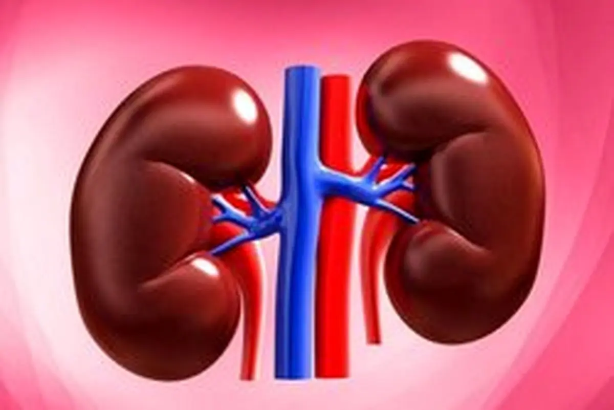 توصیه‌های تغذیه‌ای برای مبتلایان به سنگ کلیه