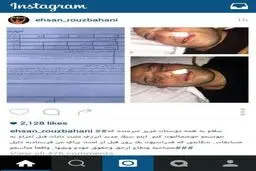 احسان روزبهانی پس از باخت/ عکس