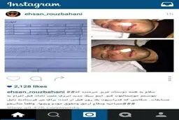 احسان روزبهانی پس از باخت/ عکس