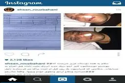 احسان روزبهانی پس از باخت/ عکس