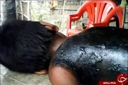 تصاویری رقت بار از اجساد سوخته مسلمانان میانمار