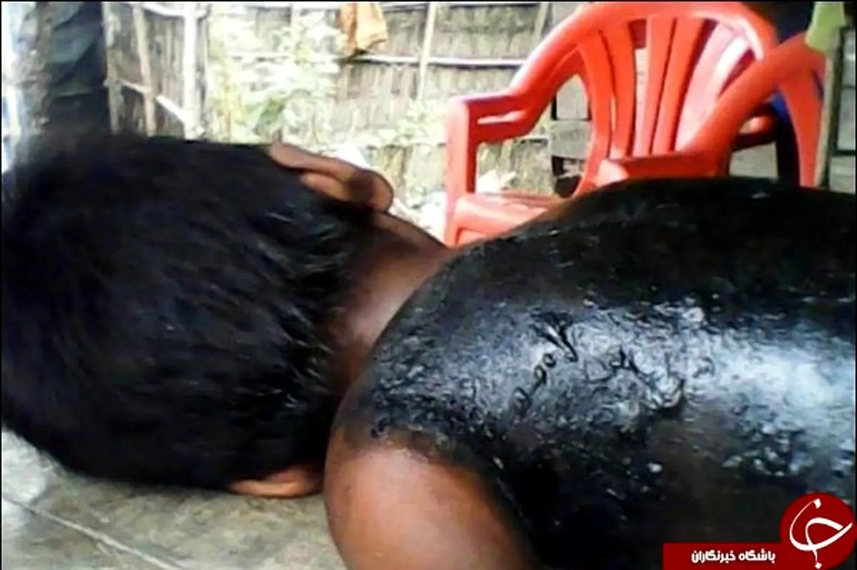 تصاویری رقت بار از اجساد سوخته مسلمانان میانمار