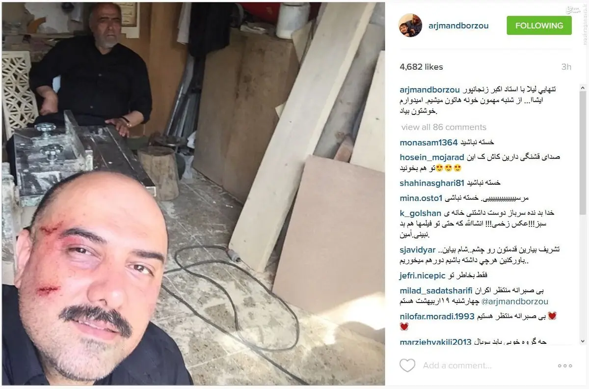 سلفی برزو ارجمند پس از کتک خوردن/عکس