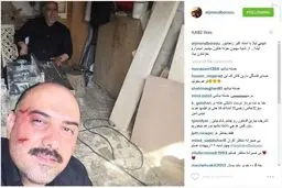 سلفی برزو ارجمند پس از کتک خوردن/عکس