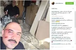 سلفی برزو ارجمند پس از کتک خوردن/عکس