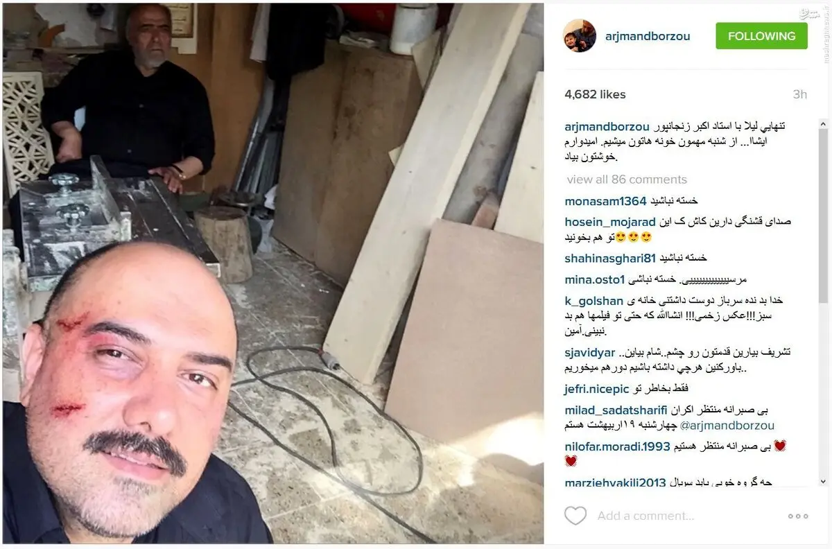 سلفی برزو ارجمند پس از کتک خوردن/عکس