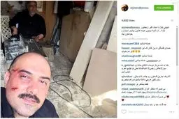 سلفی برزو ارجمند پس از کتک خوردن/عکس