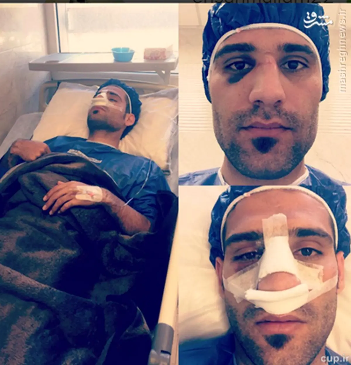 مجیدی زیر تیغ جراحی/ عکس