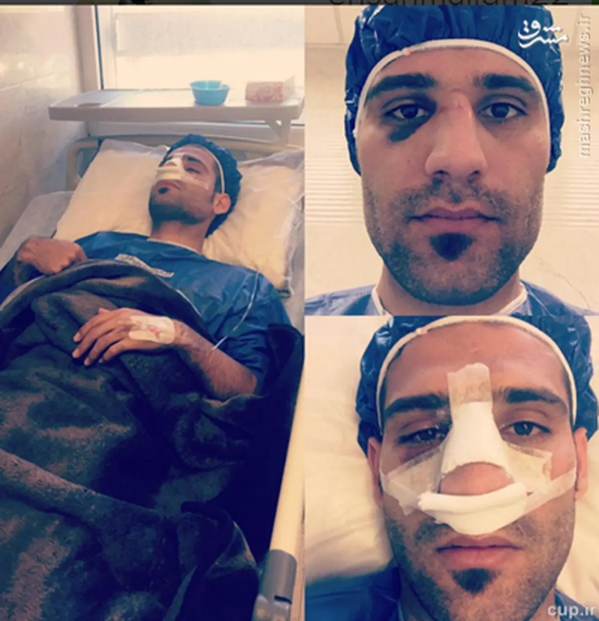 مجیدی زیر تیغ جراحی/ عکس