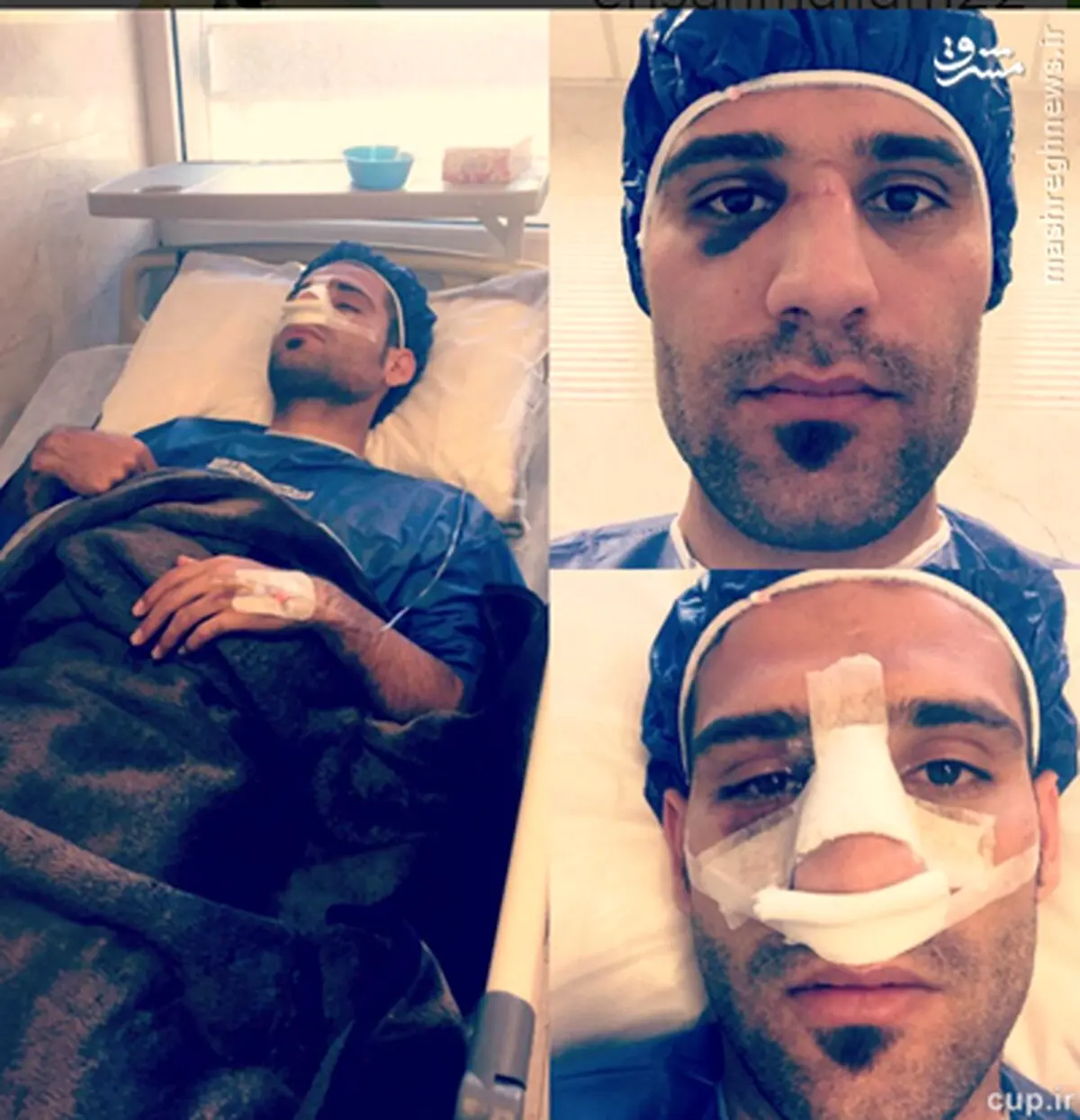 مجیدی زیر تیغ جراحی/ عکس