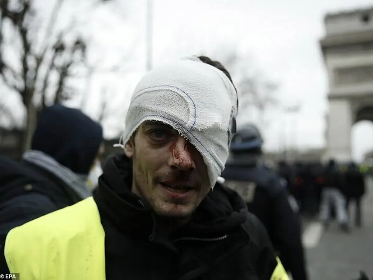 برخورد شدید پلیس پاریس با معترضان/ عکس