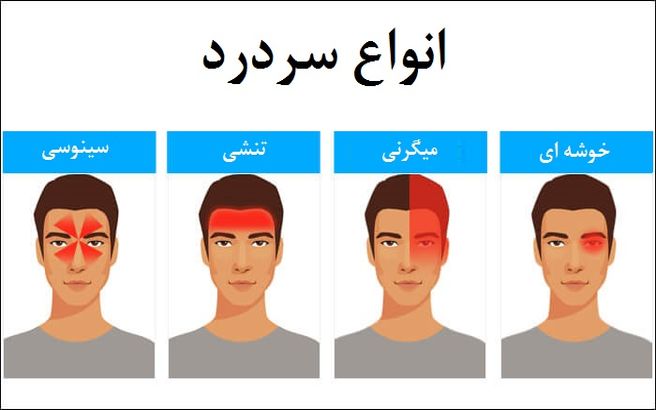 آشنایی با انواع مختلف سردرد