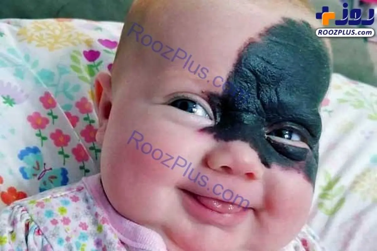 عکس/ صورت عجیب یک نوزاد