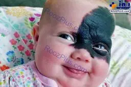 عکس/ صورت عجیب یک نوزاد