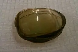 انباشته شدن ۲۷ لنز طبی در چشم زن ۶۷ ساله