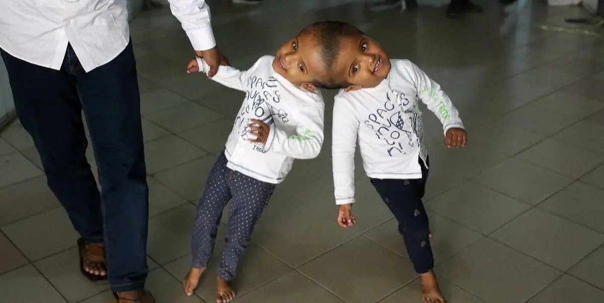 لاله و لادن بنگلادشی در آستانه عمل جراحی/عکس