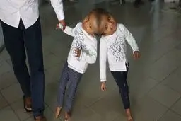 لاله و لادن بنگلادشی در آستانه عمل جراحی/عکس