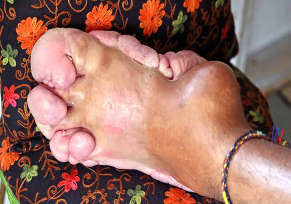 این مرد جوان برای قطع کردن پاهایش التماس می کند + تصاویر