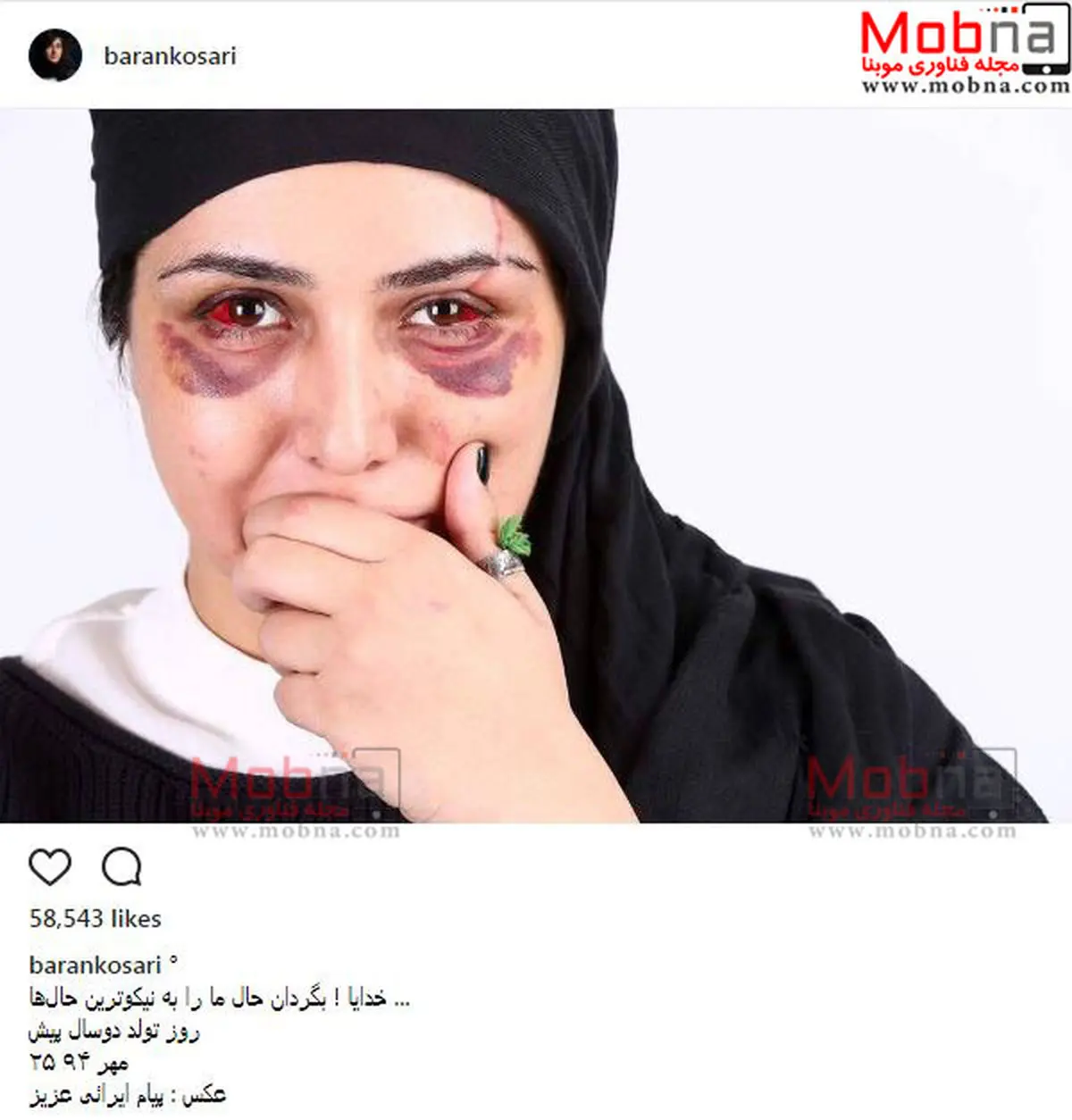 گریم کُتک خورده باران کوثری/ عکس