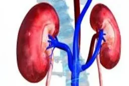 ۶ نشانه که خبر از بیماری کلیوی می‌دهد