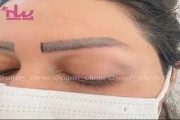 قیمت و هزینه کاشت ابرو و کاشت ابرو بصورت قسطی