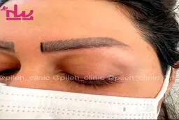 قیمت و هزینه کاشت ابرو و کاشت ابرو بصورت قسطی
