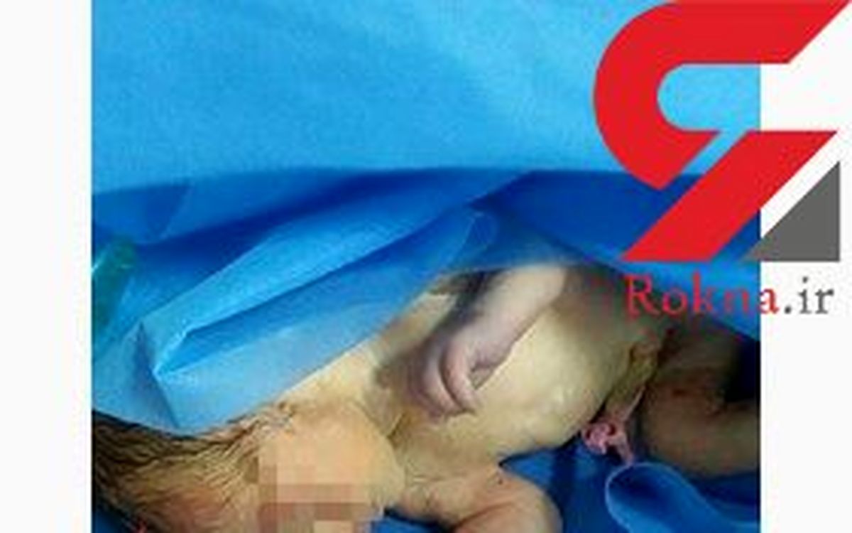 این نوزاد تازه متولد شده در شهر مهاباد رها شده بود+عکس