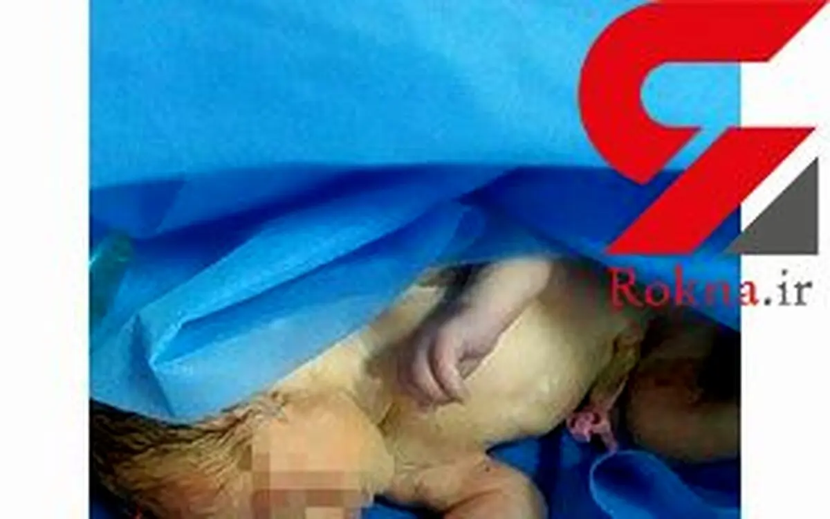 این نوزاد تازه متولد شده در شهر مهاباد رها شده بود+عکس