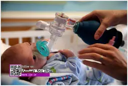 تولد یک کودک بدون بینی در امریکا +عکس