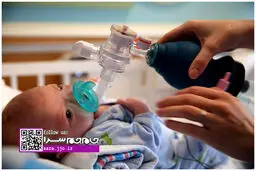 تولد یک کودک بدون بینی در امریکا +عکس