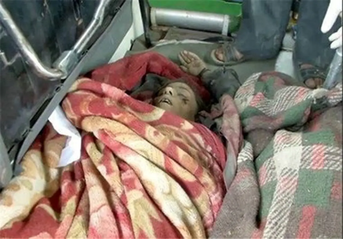 تصاویر دلخراش شهدای حمله عربستان به منطقه «بیت رجال» صنعاء(18+)