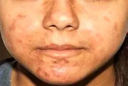 تغییر رنگ پوست را جدی بگیرید