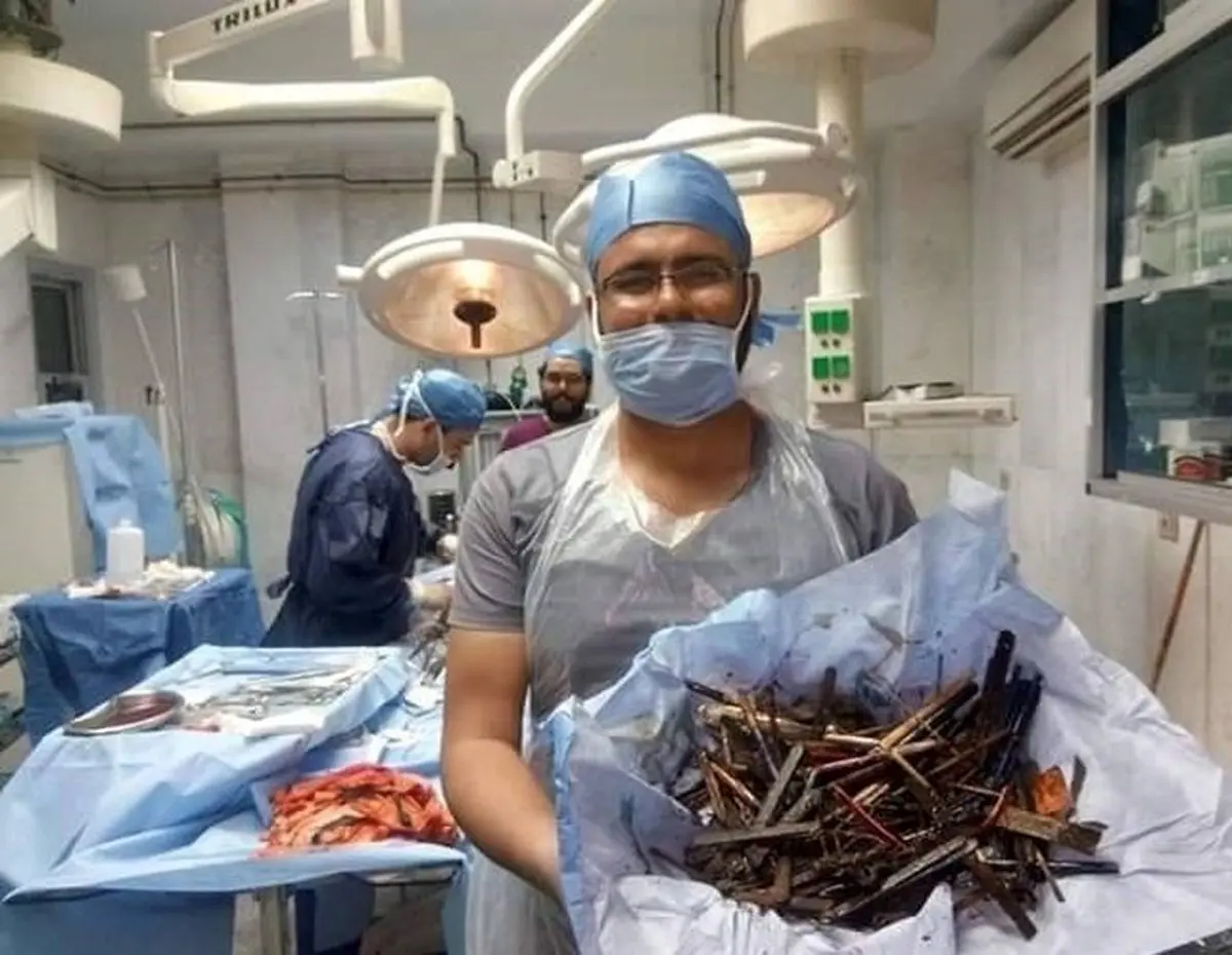 این وسایل عجیب در معده زن مصری پیدا شد!/ عکس