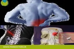 برای چه بیماری هایی به متخصص طب فیزیکی و توانبخشی مراجعه کنیم؟