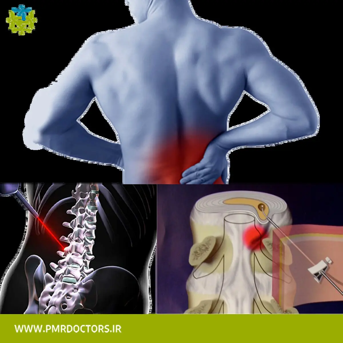 برای چه بیماری هایی به متخصص طب فیزیکی و توانبخشی مراجعه کنیم؟