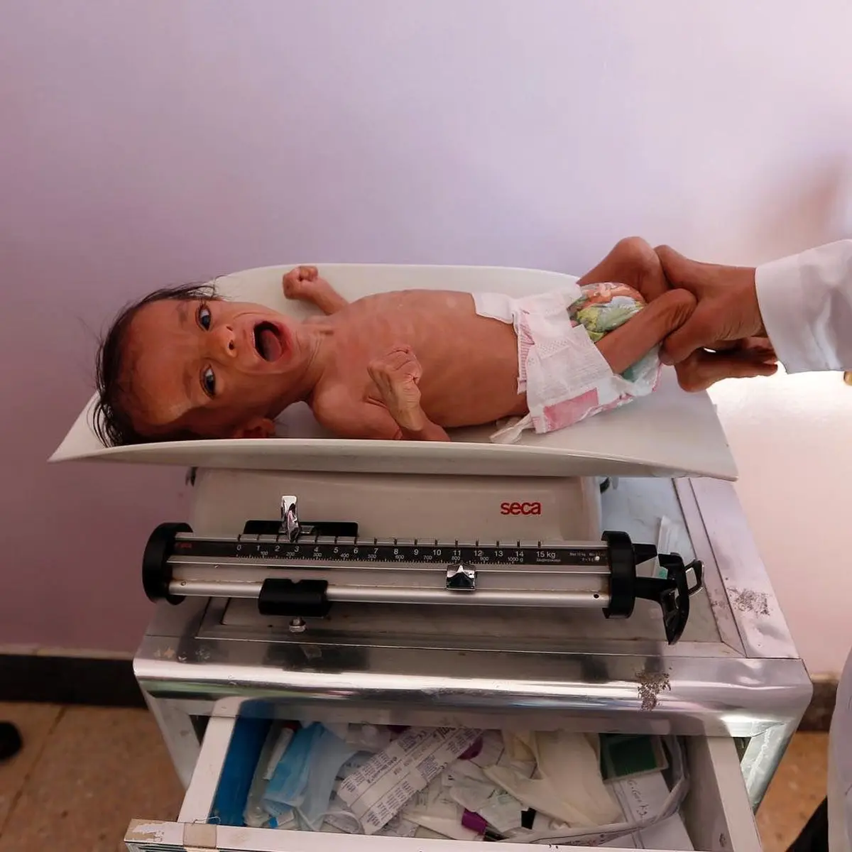 تصویر تکان دهنده بی بی سی از کودک یمنی