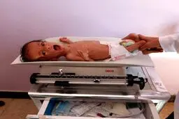 تصویر تکان دهنده بی بی سی از کودک یمنی