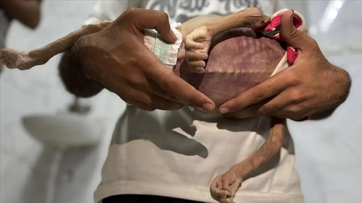 شتاب بحران انسانی در غزه همزمان با خروج دوباره آمریکا از یونسکو