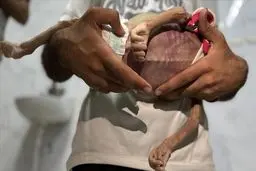 شتاب بحران انسانی در غزه همزمان با خروج دوباره آمریکا از یونسکو