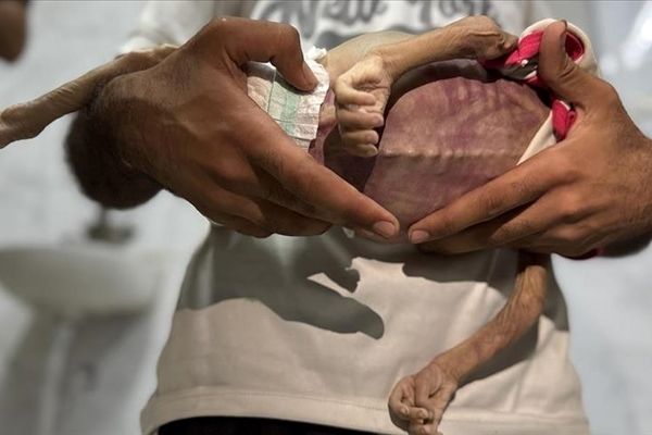 شتاب بحران انسانی در غزه همزمان با خروج دوباره آمریکا از یونسکو