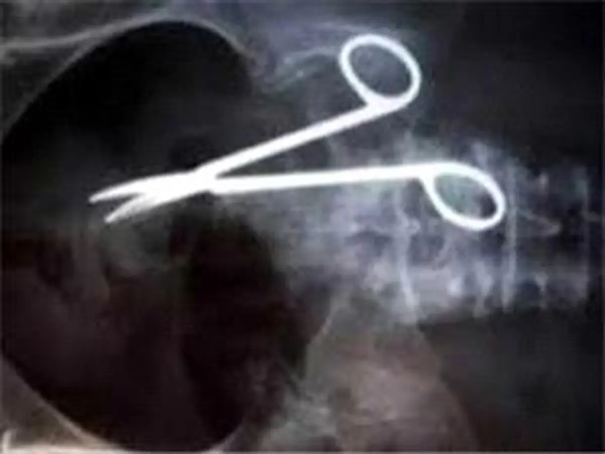 ماجرای جاماندن قیچی در بدن بیمار!