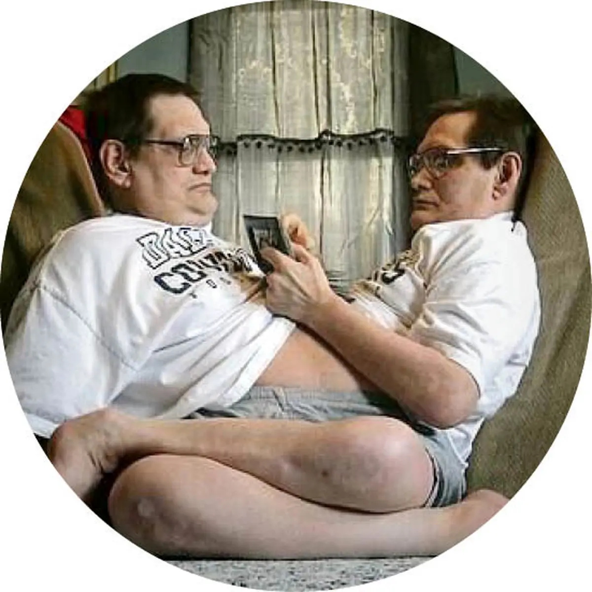 تسلیم نشدنی‌ترین دوقلو‌های عجیب دنیا! + تصاویر